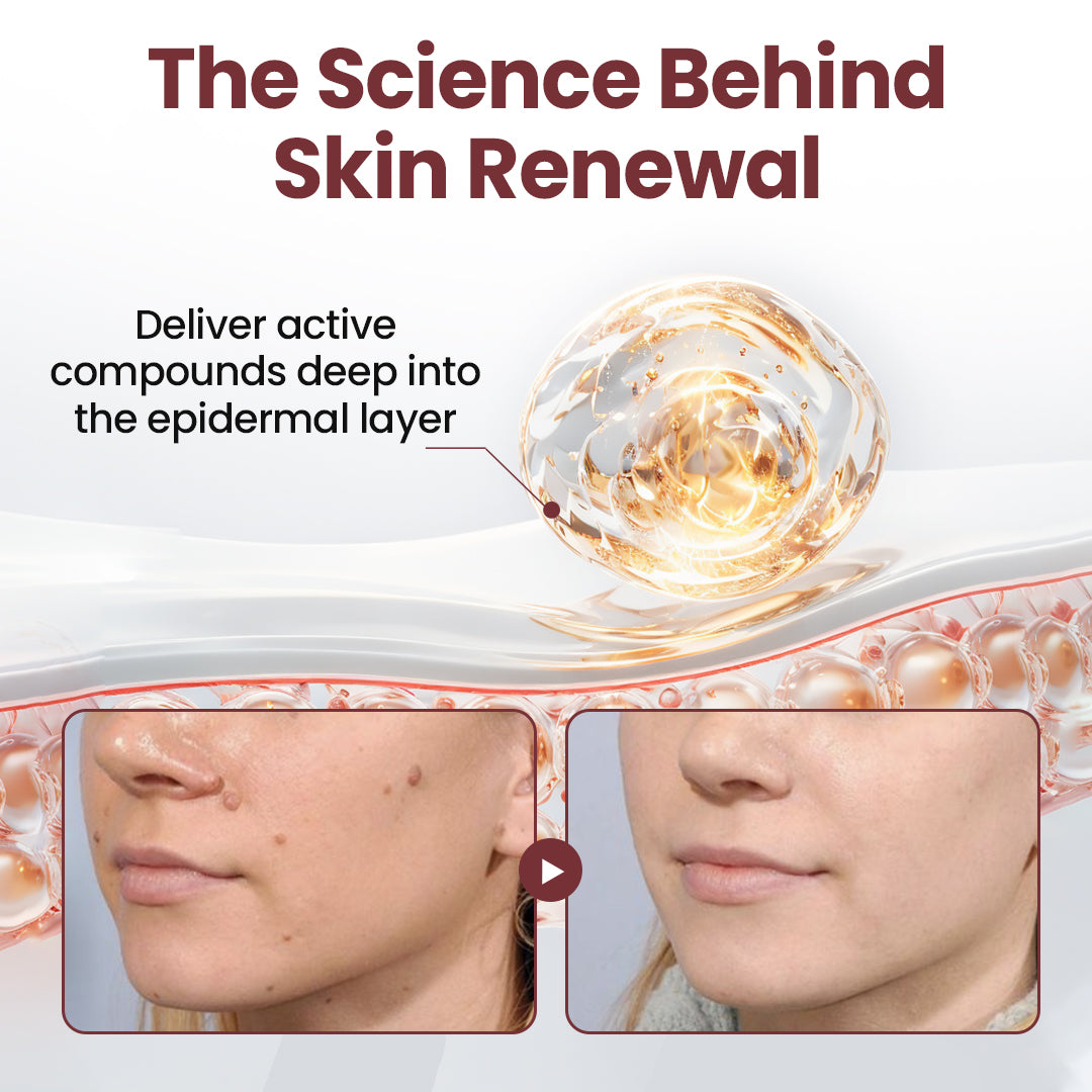 KeraErase Dual-Action Renewal Cream