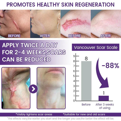 𝑹𝒆𝑮𝒆𝒏𝑺𝒄𝒂𝒓 𝑺𝒕𝒆𝒎 𝑪𝒆𝒍𝒍 𝑹𝒆𝑝𝒂𝒊𝒓 𝑮𝒆𝒍 (𝑽𝒊𝒔𝒊𝒃𝒍𝒆 𝑺𝒄𝒂𝒓 𝑰𝒎𝒑𝒓𝒐𝒗𝒆𝒎𝒆𝒏𝒕 𝒊𝒏 7 𝑫𝒂𝒚𝒔)